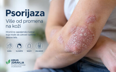 Psorijaza: simptomi, vrste i savremeno lečenje