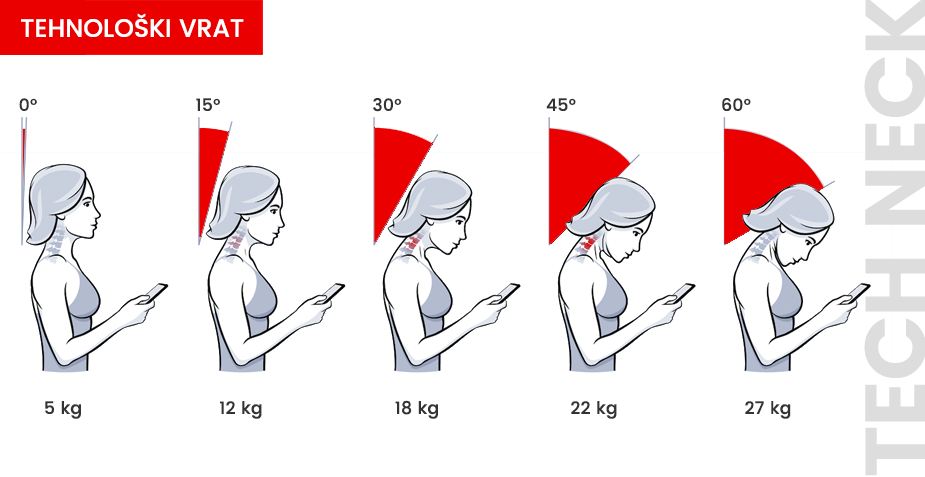 Šema opterećenja vrata pri korišćenju mobilnog telefona.